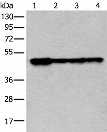 Western blot analysis of 293T and 231 cell lysates using VRK1 Polyclonal Antibody at dilution of 1:400