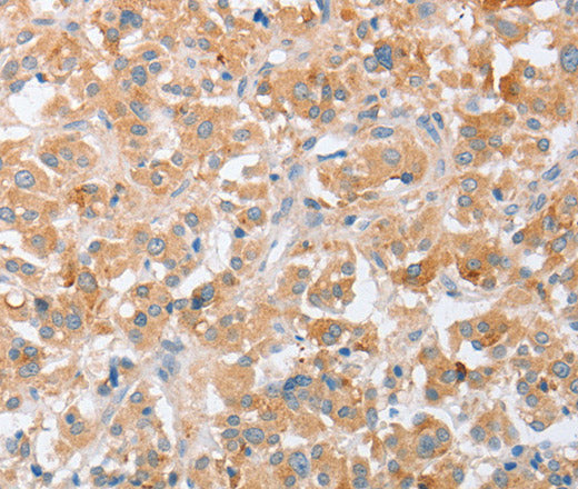 Anti-Human SIGLEC9 Antibody - ABMIUM