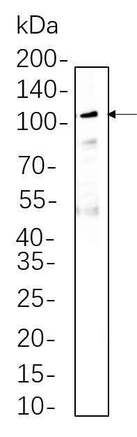 Anti-Mouse/Rat MMP9 Antibody [B1145] - ABMIUM