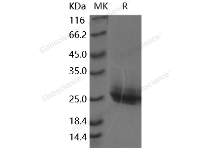 Recombinant Human Frizzled-10/FZD10 Protein (His Tag) - ABMIUM