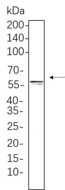Anti-Human/Mouse/Rat E2F-1 Antibody [B1135]