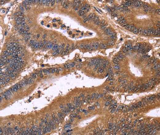 Anti-Human/Mouse/Rat CDC37L1 Antibody