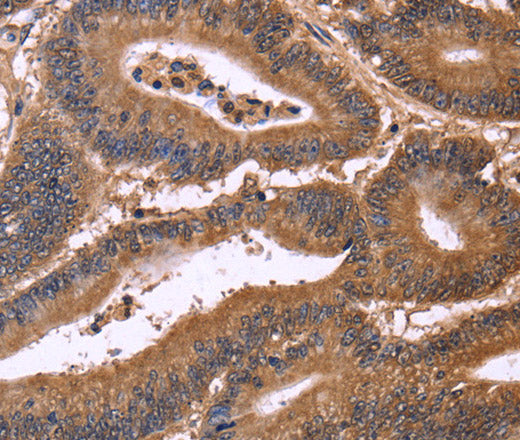 Anti-Human/Mouse/Rat CDC37L1 Antibody - ABMIUM