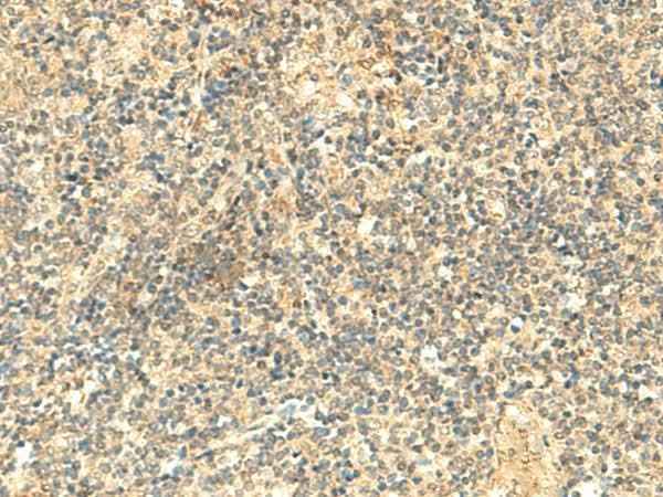 Anti-Human/Mouse NTAN1 Antibody