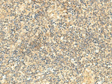 Immunohistochemistry of paraffin-embedded Human tonsil tissue using NTAN1 Polyclonal Antibody at dilution of 1:50(×200)
