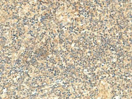 Anti-Human/Mouse NTAN1 Antibody