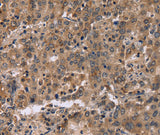 Anti-Human FAM107A Antibody - ABMIUM