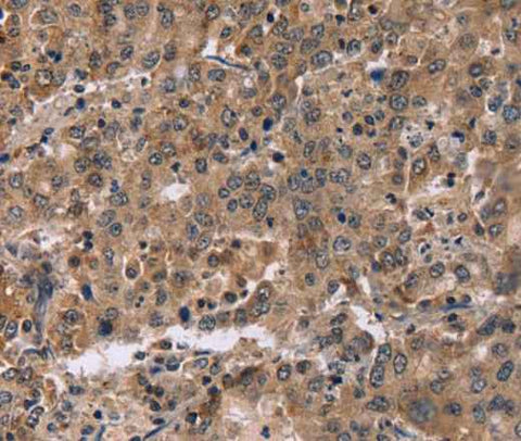 Anti-Human FAM107A Antibody
