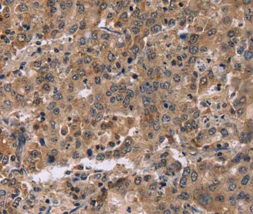 Anti-Human FAM107A Antibody