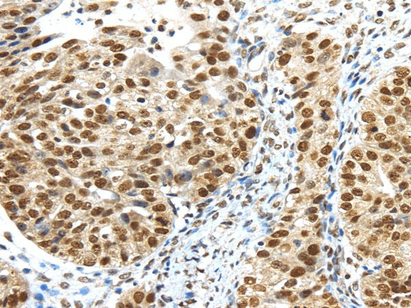 Anti-Human/Mouse TRIM33 Antibody - ABMIUM