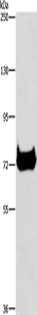 Anti-Human/Mouse CEL Antibody - ABMIUM