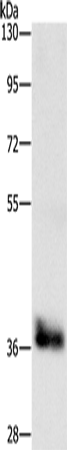Anti-Human/Mouse/Rat CEBPE Antibody - ABMIUM