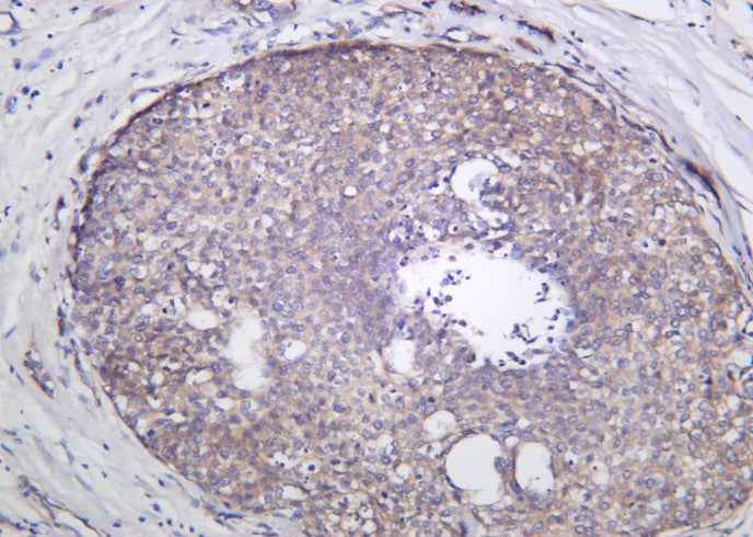 Anti-Human/Mouse/Rat GCN2 Antibody [B1013] - ABMIUM