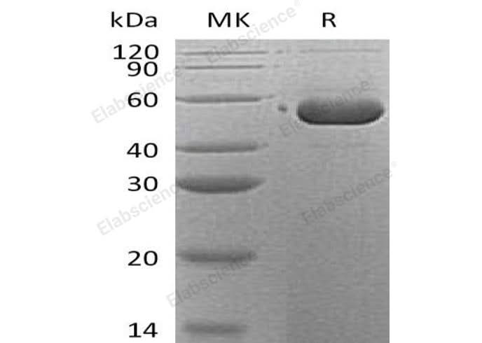 Recombinant Human SerpinB12/SERPINB12 Protein (His Tag) - ABMIUM