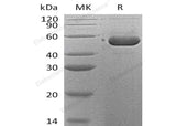 Recombinant Human SerpinB12/SERPINB12 Protein (His Tag) - ABMIUM