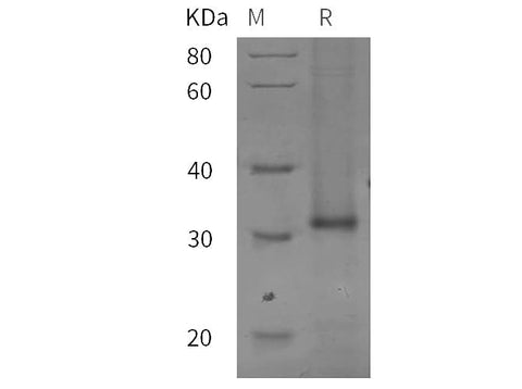 SDS-PAGE analysis of Mouse IL7R/IL-7R/CD127 proteins, 2 μg/lane of Recombinant Mouse IL7R/IL-7R/CD127 proteins was resolved with SDS-PAGE under reducing conditions, showing bands at 32 kDa.
