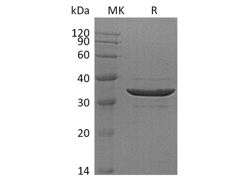 Recombinant Human ACYP2 Protein (GST Tag) - ABMIUM