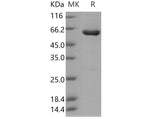 > 92 % as determined by reducing SDS-PAGE.