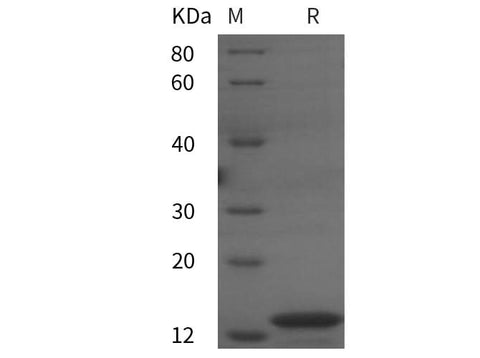 SDS-PAGE analysis of Vaccinia virus VACV(A27L) proteins, 2 μg/lane of Recombinant Vaccinia virus VACV(A27L) proteins was resolved with SDS-PAGE under reducing conditions, showing bands at 14 kDa.