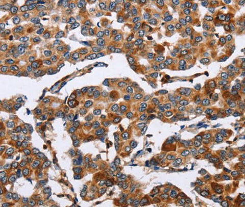 Anti-Human/Mouse/Rat ENPP5 Antibody - ABMIUM