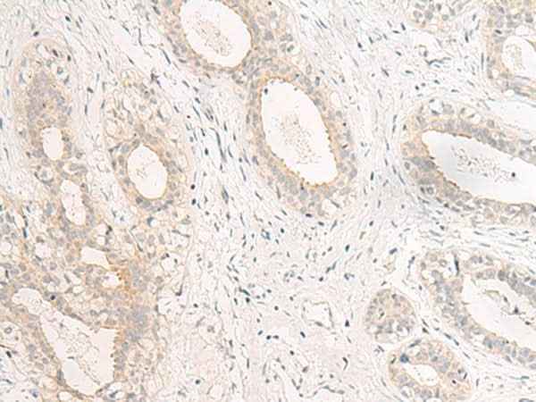 Anti-Human GPR157 Antibody