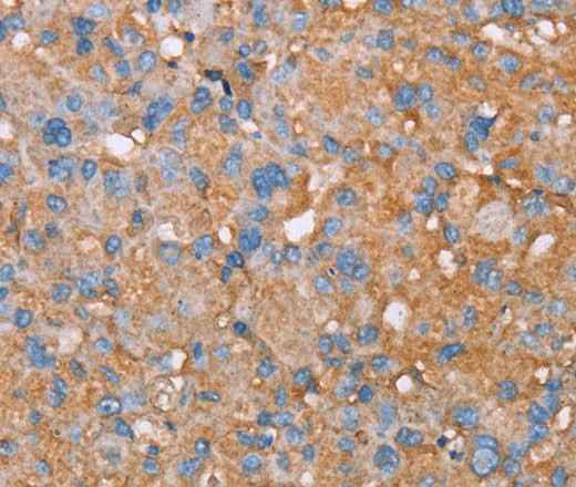 Anti-Human PAGE5 Antibody