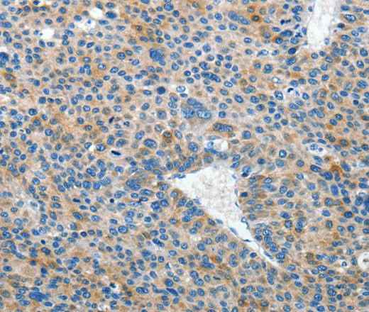 Anti-Human/Mouse EPHB3 Antibody