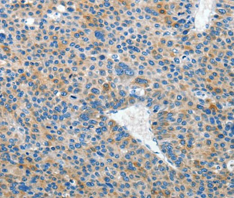 Anti-Human/Mouse EPHB3 Antibody - ABMIUM