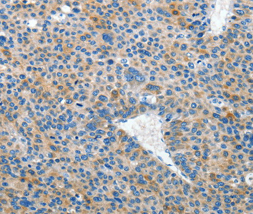 Anti-Human/Mouse EPHB3 Antibody - ABMIUM