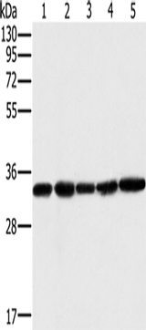 Anti-Human/Mouse MTCH2 Antibody - ABMIUM