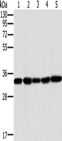Anti-Human/Mouse MTCH2 Antibody - ABMIUM