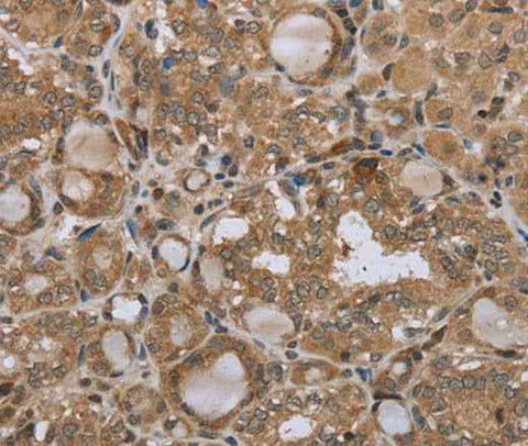 Anti-Human/Mouse STMN2/3/4 Antibody