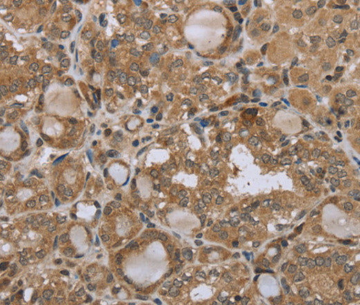Anti-Human/Mouse STMN2/3/4 Antibody - ABMIUM