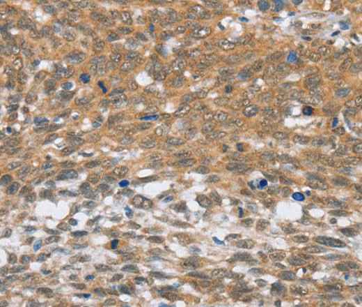 Anti-Human/Mouse/Rat MLH1 Antibody
