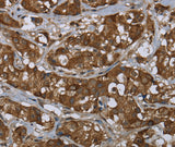 Anti-Human PIP Antibody - ABMIUM