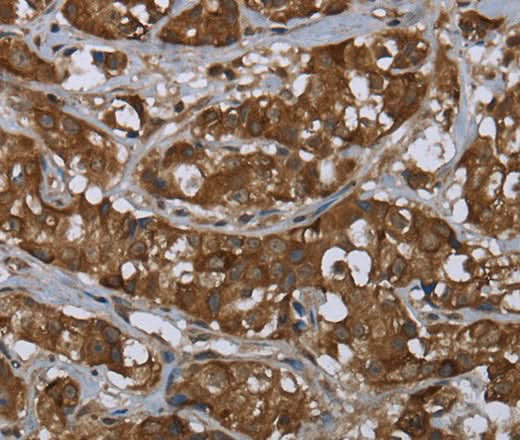 Anti-Human PIP Antibody - ABMIUM