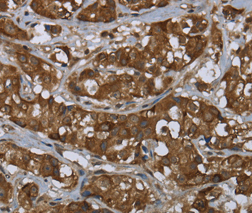 Anti-Human PIP Antibody - ABMIUM