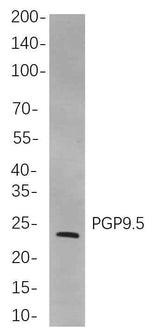 Anti-Human/Mouse/Rat PGP9.5 Antibody [B789]
