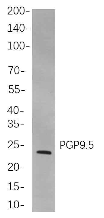 Anti-Human/Mouse/Rat PGP9.5 Antibody [B789] - ABMIUM