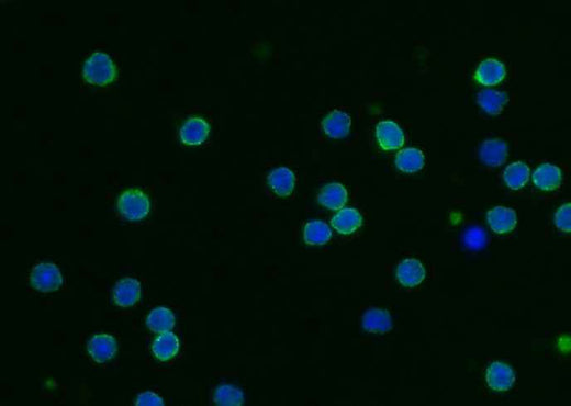 Anti-Mouse CD55 Antibody [B451] - ABMIUM