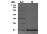 Recombinant Human Profilin-2/PFN2 Protein - ABMIUM