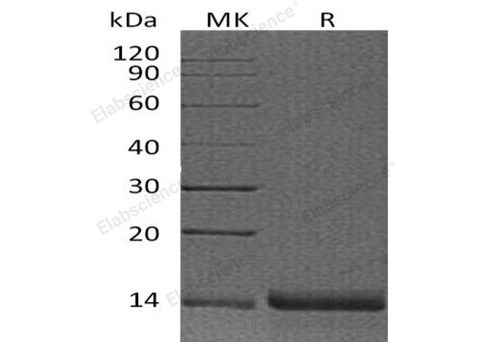 Recombinant Human Profilin-2/PFN2 Protein - ABMIUM