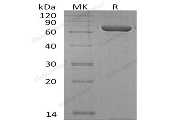 Recombinant Human Copine-1/CPNE1 Protein (His Tag) - ABMIUM