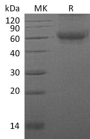 Recombinant Mouse DDR2 Kinase/CD167b Protein (His Tag) - ABMIUM