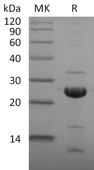 Recombinant SARS-CoV-2 NSP1 Protein (His Tag) - ABMIUM