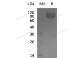 Recombinant Human MAG/Siglec-4a Protein (His Tag) - ABMIUM