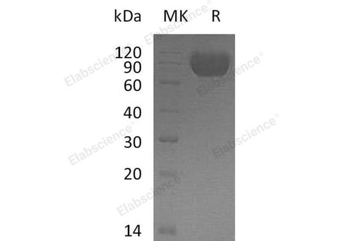 Recombinant Human MAG/Siglec-4a Protein (His Tag) - ABMIUM