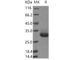 Recombinant Human RAB11B Protein (His Tag) - ABMIUM