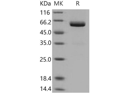 Recombinant Mouse VSIG4 Protein (His & Fc Tag) - ABMIUM