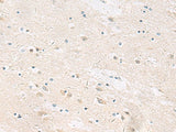 Immunohistochemistry of paraffin-embedded Human brain tissue using ANKS6 Polyclonal Antibody at dilution of 1:55(×200)